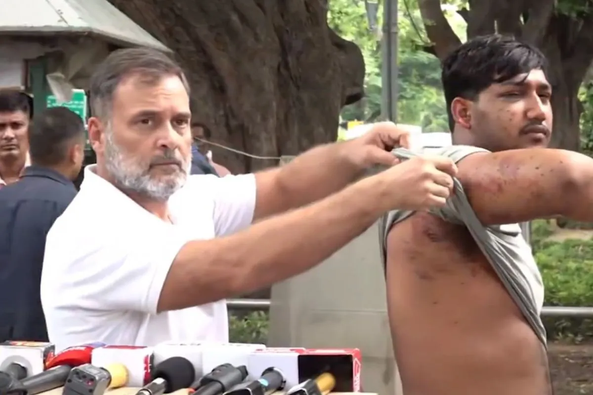 राहुल गांधी ने कैमरे पर दिखाए छात्र के जख्म, बोले—तिरंगा लेकर खड़े युवा पर चली पैलेट गन, एक आंख की रोशनी गई