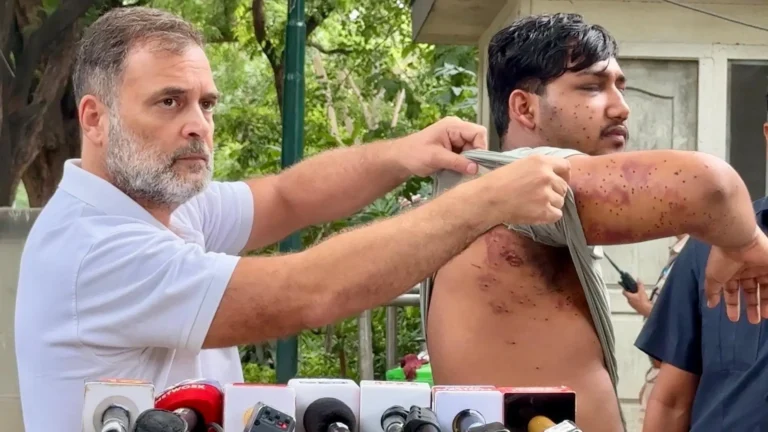 छात्रों पर पैलेट का सच: RTI ने खोली पुलिस कार्रवाई की परतें, 10 घायल